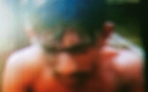 রায়পুরা হাসিমপুর বাজারে ৩ যুবকের উপর এসিড নিক্ষেপ 