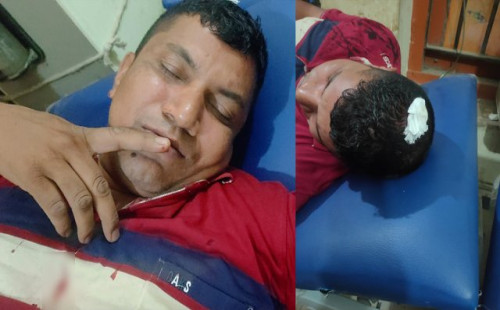 মিরপুর থানায় নেওয়ার পথে দুই পুলিশকে হাতুড়িপেটা করলো আসামি 