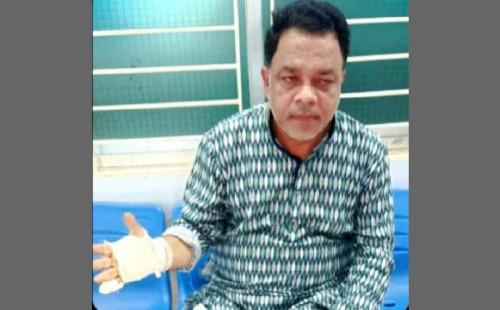 চকরিয়ায় বিএনপি নেতাকে ছুরিকাঘাতে হত্যা চেষ্টার অভিযোগ 